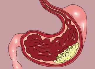47歲女子堅持每天吃大蒜說可以防癌，有沒有什麼科學依據？