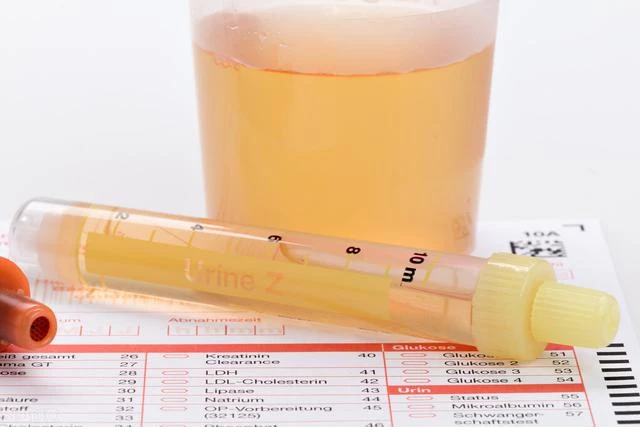 血糖偏高，小便先知？小便若出現這3異常，警惕是糖尿病早期信號