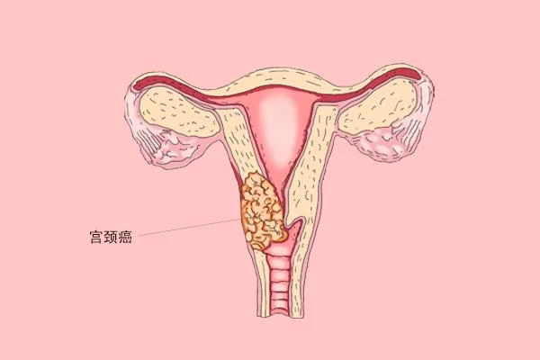 明明都絕經了，有人顯老，有人卻顯年輕，究竟差在哪？告訴你答案