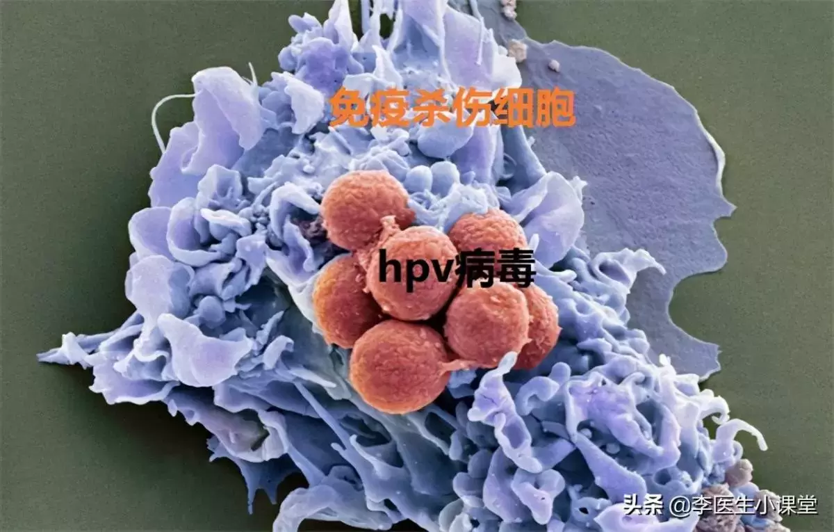 女人腿疼是病變警示！42歲大姐「發現已晚期」4個月就離開　醫師無奈「不想癌症提前來」：2食物少吃 