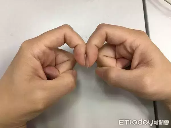 「手指不一樣」小心肺癌來敲門！醫生靠1個動作自測：快看你有沒有 