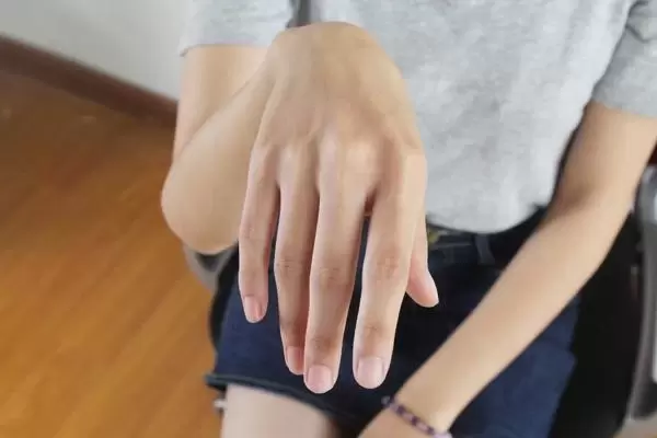 50歲左右女性，早起後手指僵硬，痛得難以活動，是怎麼了？