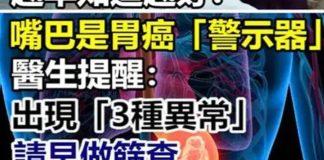 越早知道越好!嘴巴是胃癌的「警示器」醫生提醒:出現「三種異常」請早做篩查