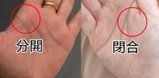 手掌這兩條線「分開」還是「閉合」 預示晚年「福命還是苦命」:太准了!