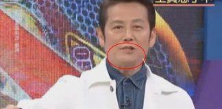 突然臉歪嘴斜!66歲徐乃麟「錄影一半感到不對勁」 親曝「危急時刻畫面」警惕:把握黃金治療期!