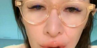 健康亮紅燈!46歲台灣天後「雙頰凹陷暴瘦」粉絲認不出 虛弱嘆「還要再做手術」:過得很辛苦