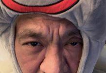 驚傳罹患大腸癌!62歲綜藝天王「裝人工肛門搶命」